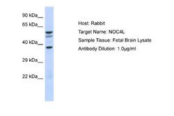 NOC4L Rabbit anti-Human, Polyclonal, Novus Biologicals 0.1ml; Unconjugated:Antibodies,